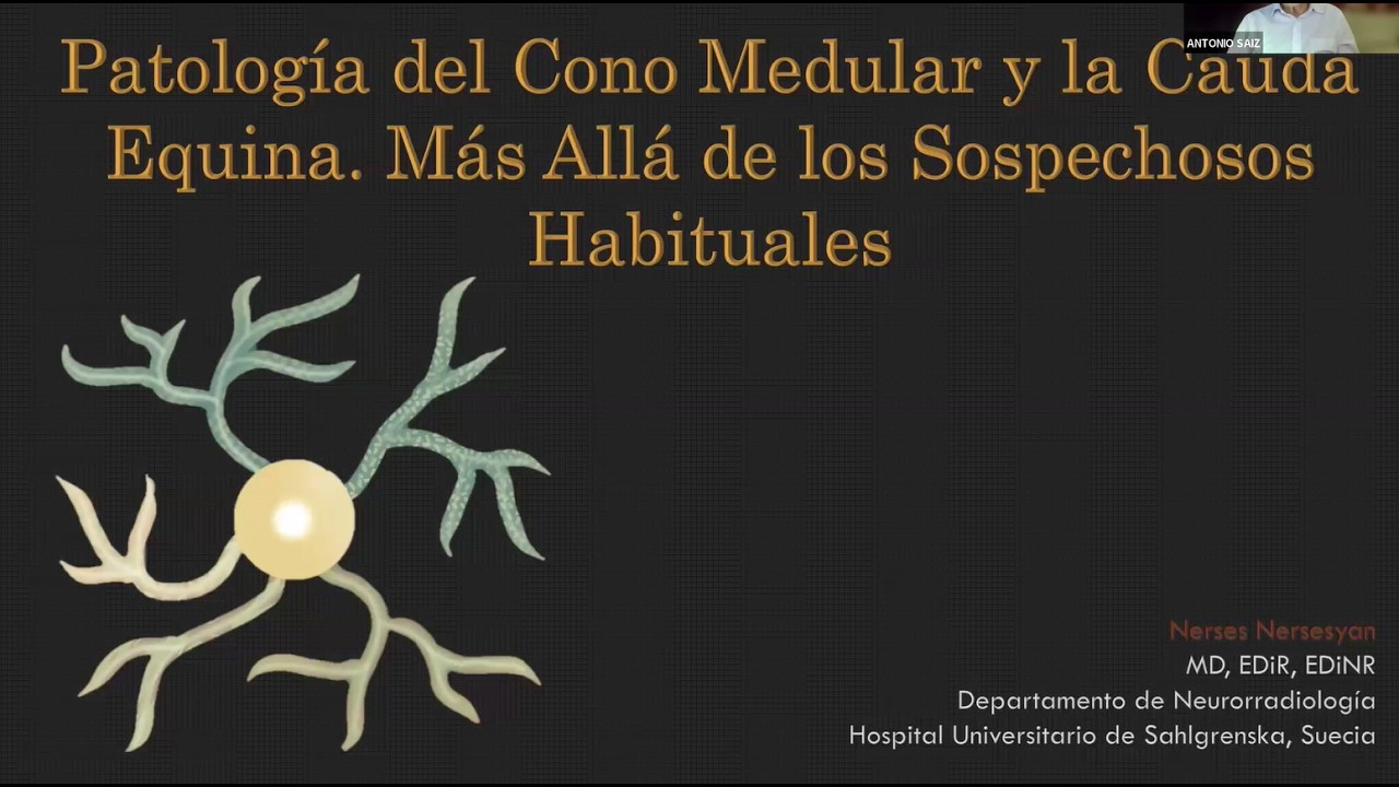 896. Patología del Cono Medular y Cauda Equina