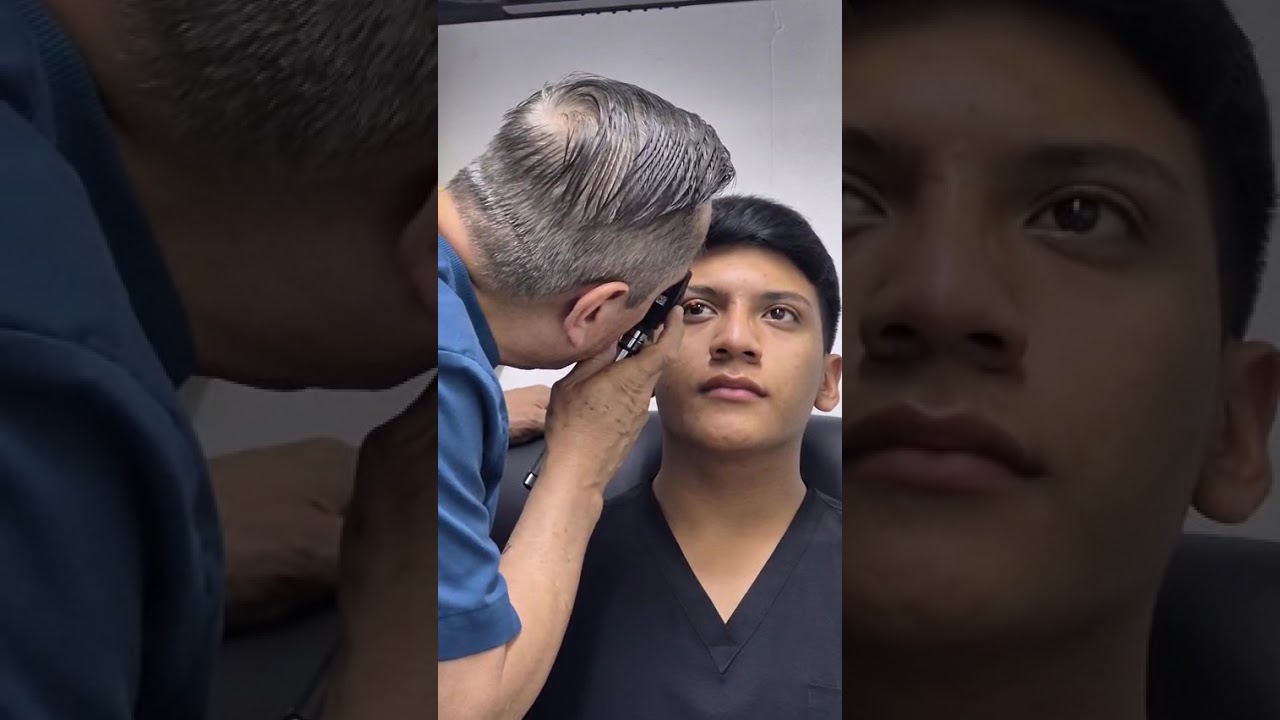 Oftalmoscopia directa metodo 2