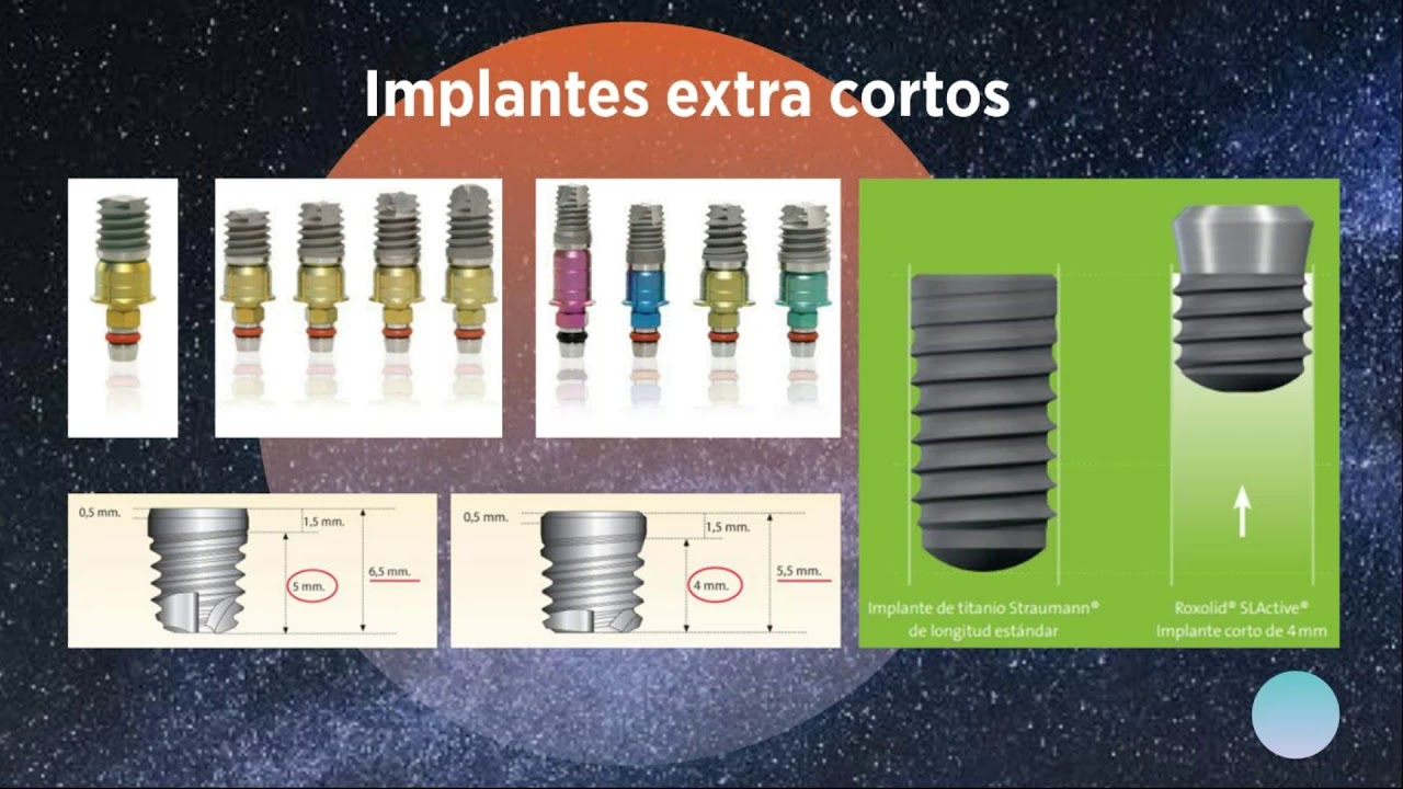 Implantes dentales cortos y extra cortos