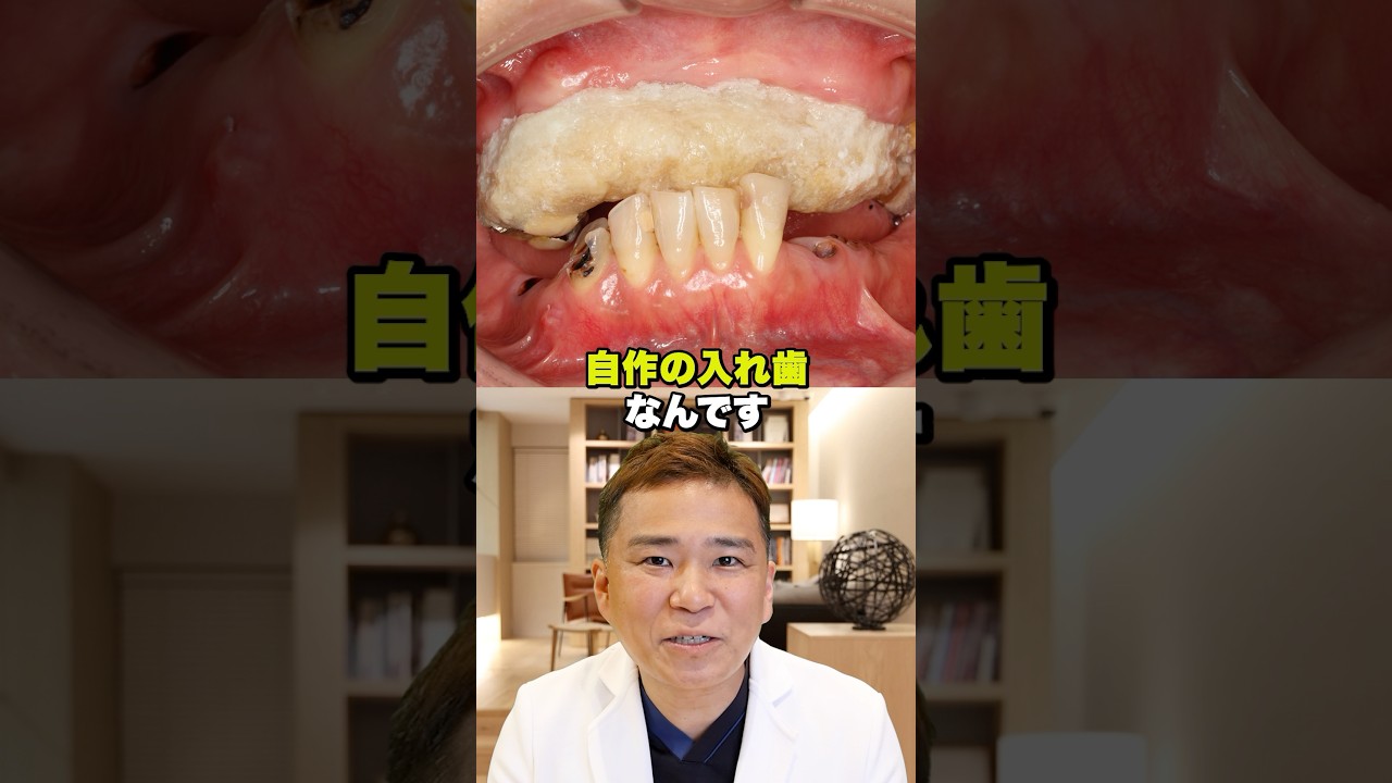 30年間自分で調整し続けた入れ歯で生きてきたある女性の本音