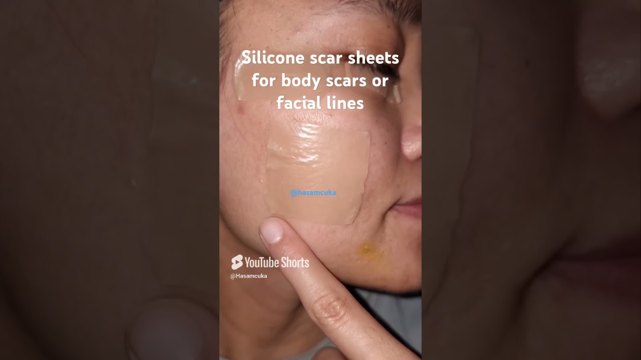 silicone scar sheets for body scars and facial lines. #ScarCare #SkincareRoutine