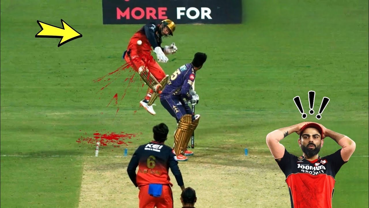 Top 10 Dangerous 🤯 Injuries in Cricket