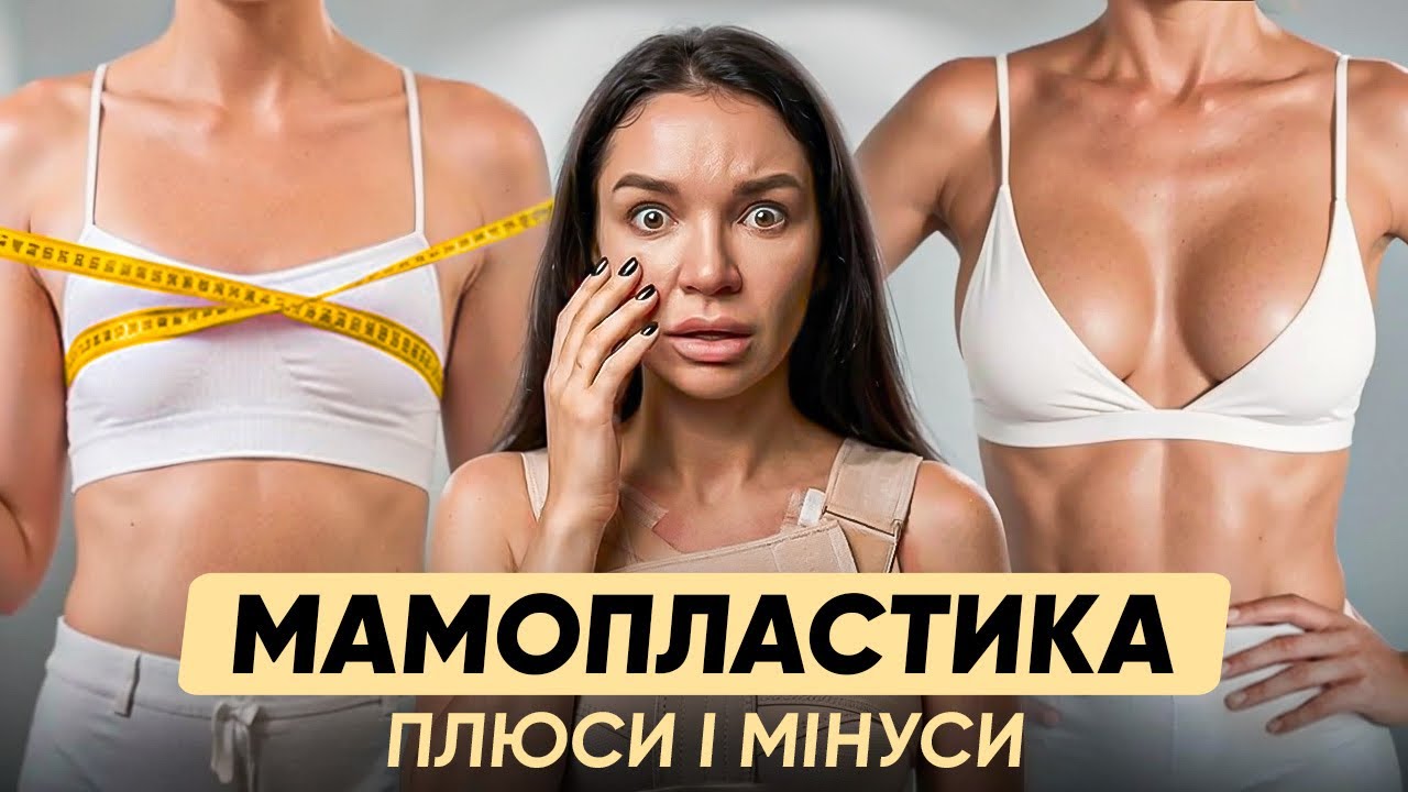 Я ЗРОБИЛА МАМОПЛАСТИКУ. ЧЕСНО ДО і ПІСЛЯ. ЛІКАРНЯНИЙ ВАЙБ.