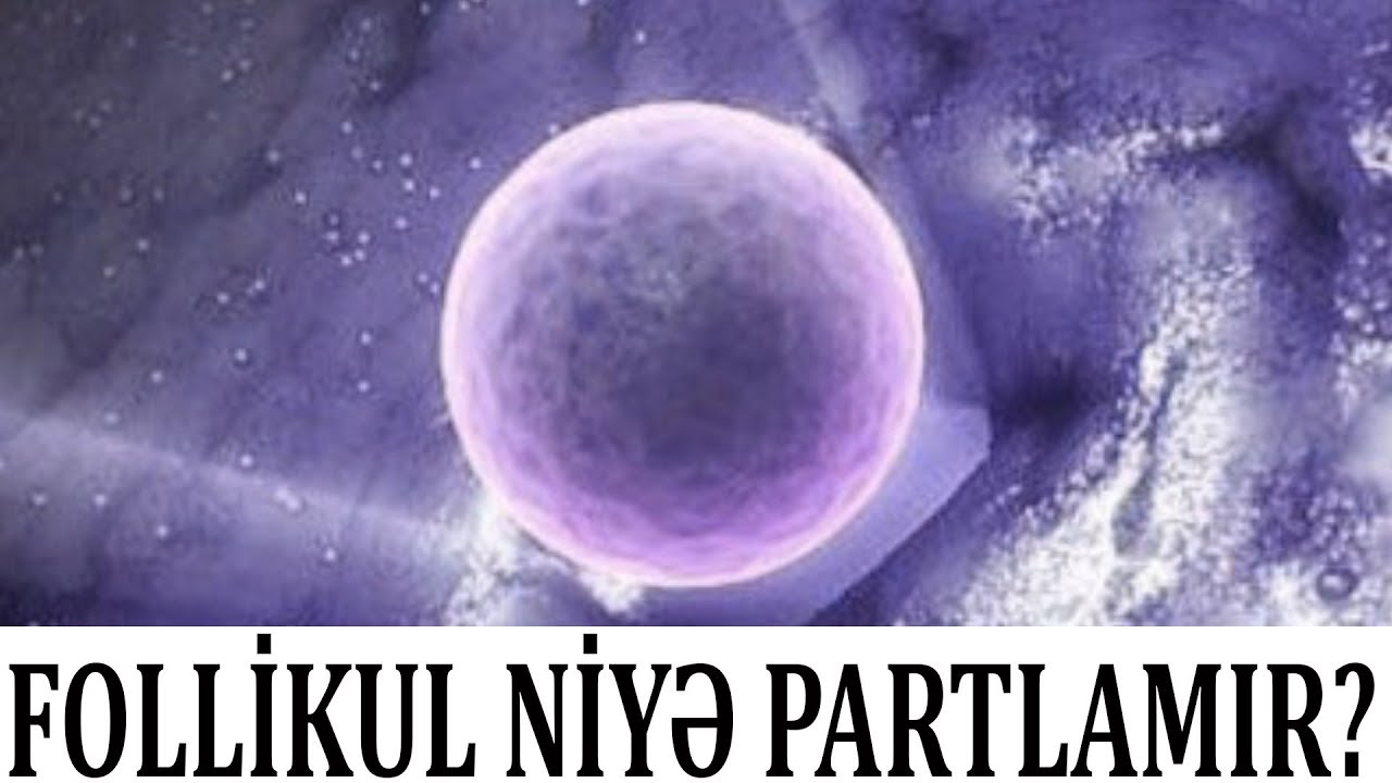 Follikul partlamırsa, nə etmək lazımdır?