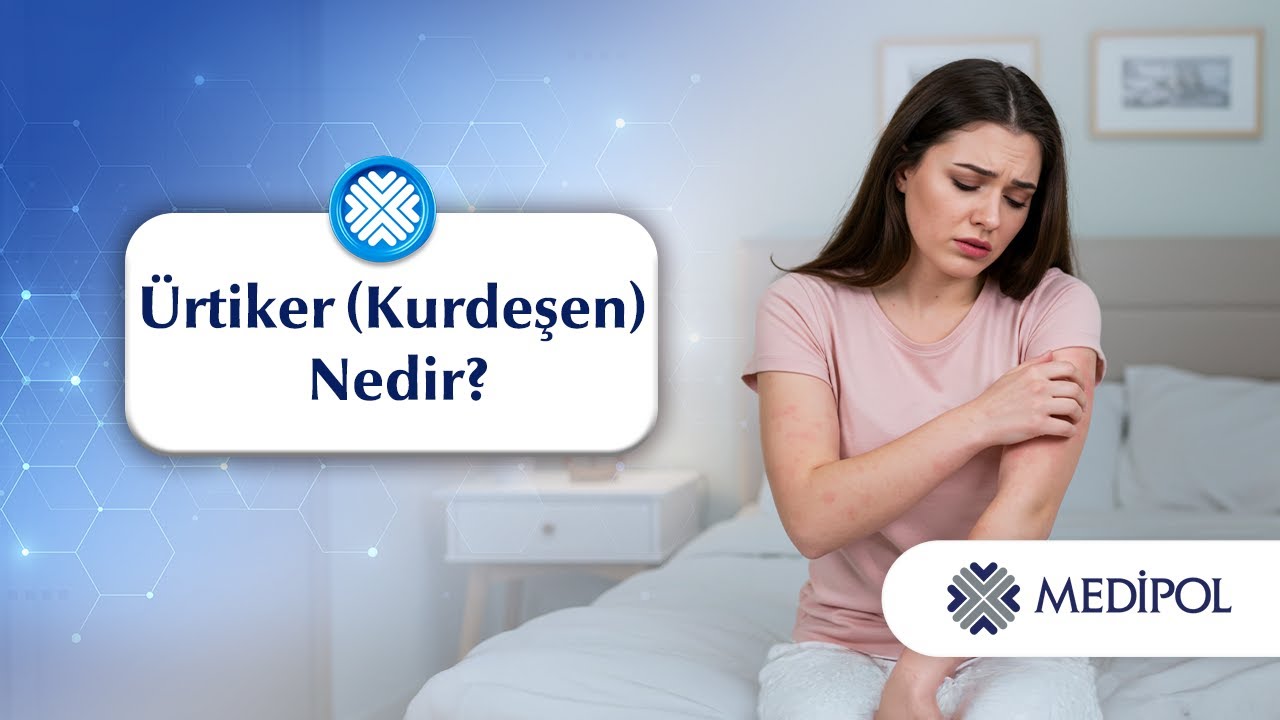 &Uuml;rtiker (Kurdeşen) Nedir?