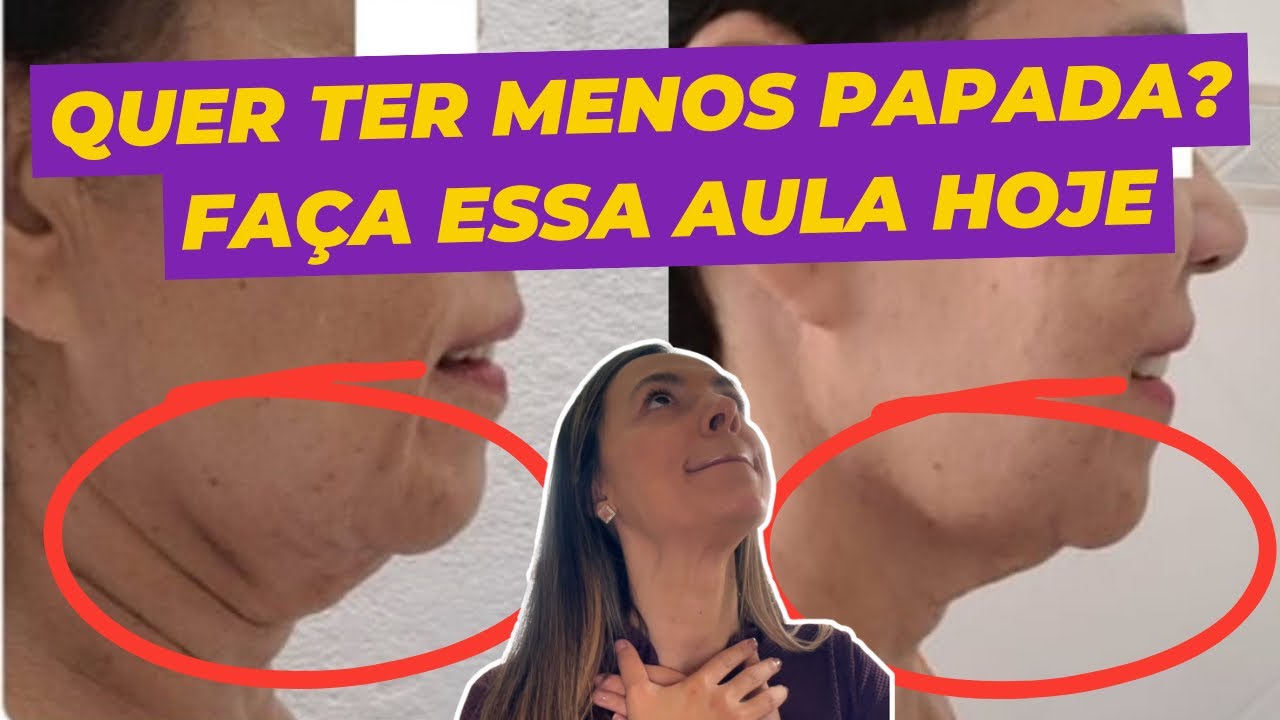 Aulão Anti-Papada - O Segredo Natural que não te contam! Faça junto!