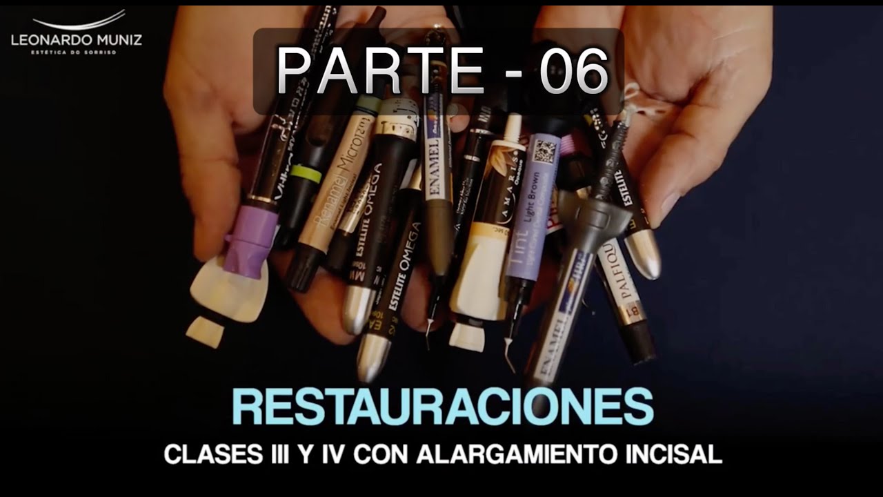 Restauraciones Clase III y IV con Alargamiento Incisal - Parte 6