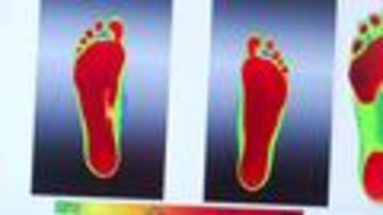 Custom orthotics improve back pain