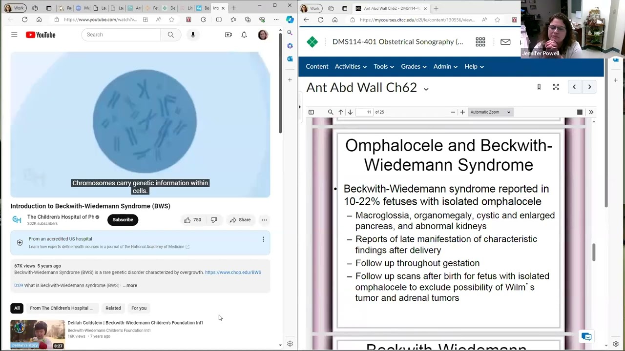 DMS 114 Ch 62 Fetal Anterior Abdominal Wall