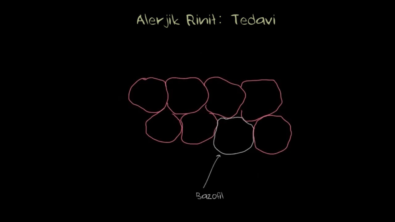 Alerjik Rinit Tanısı ve Tedavisi (Solunum Sistemi Hastalıkları | Sağlık Bilgisi ve Tıp)