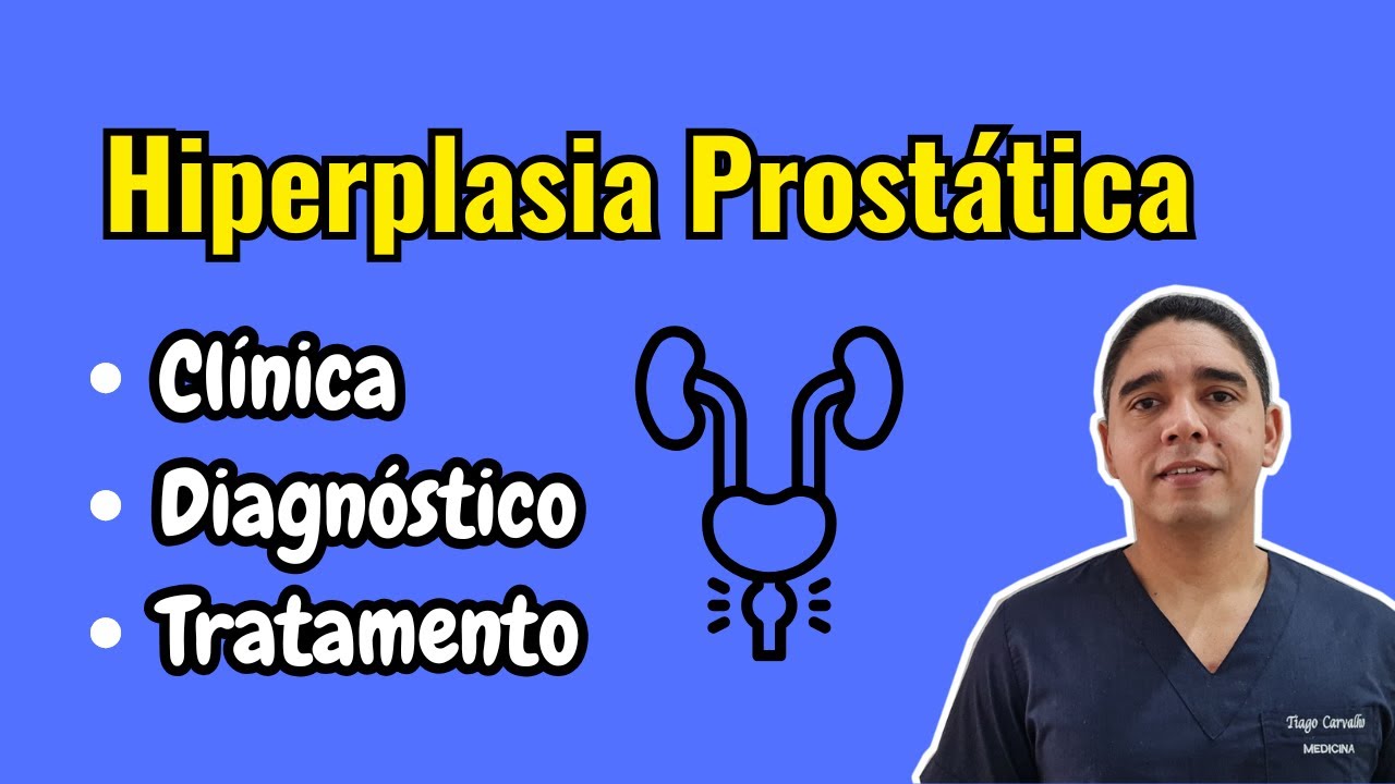 Hiperplasia Prostática Benigna - diagnóstico e tratamento