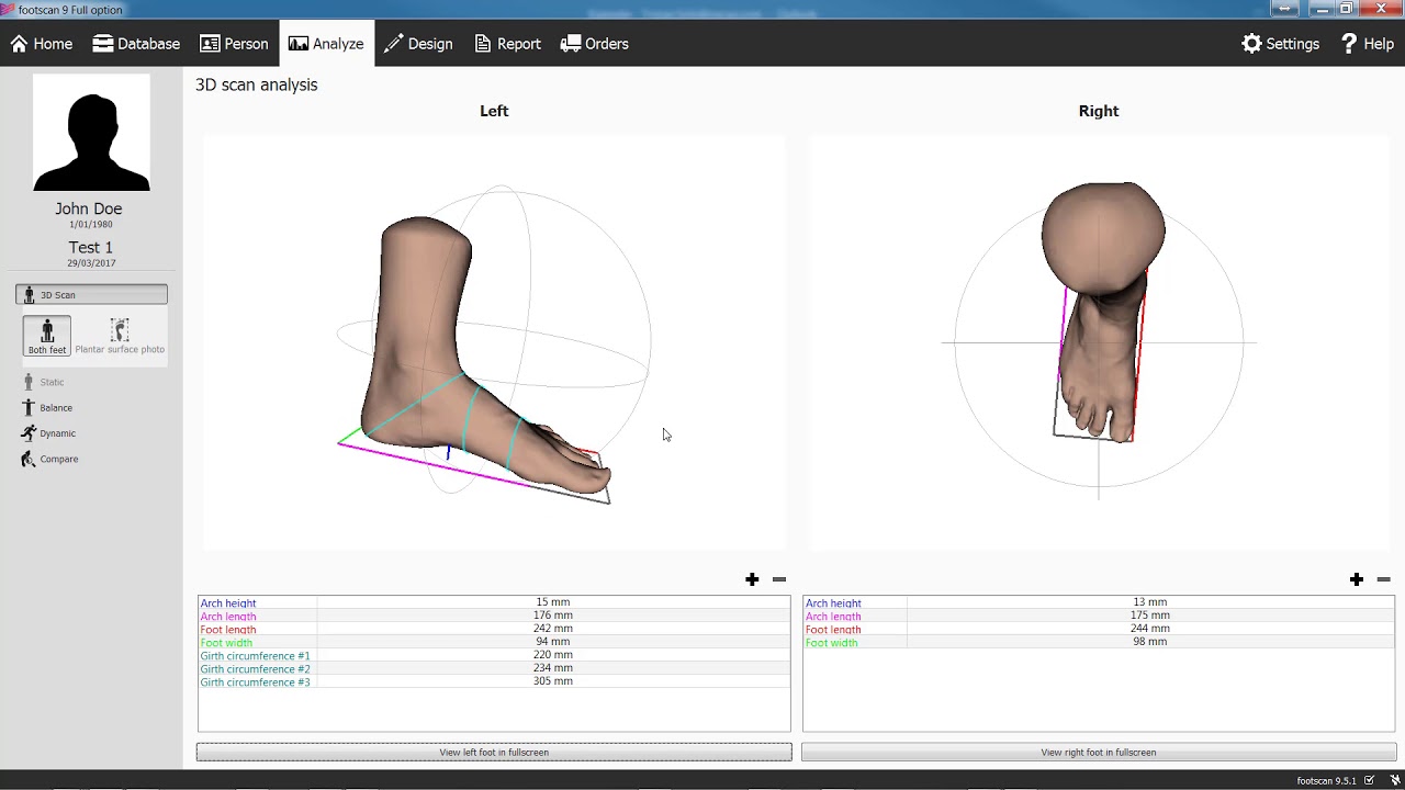 3D Foot Scanners (iQube, Tiger)