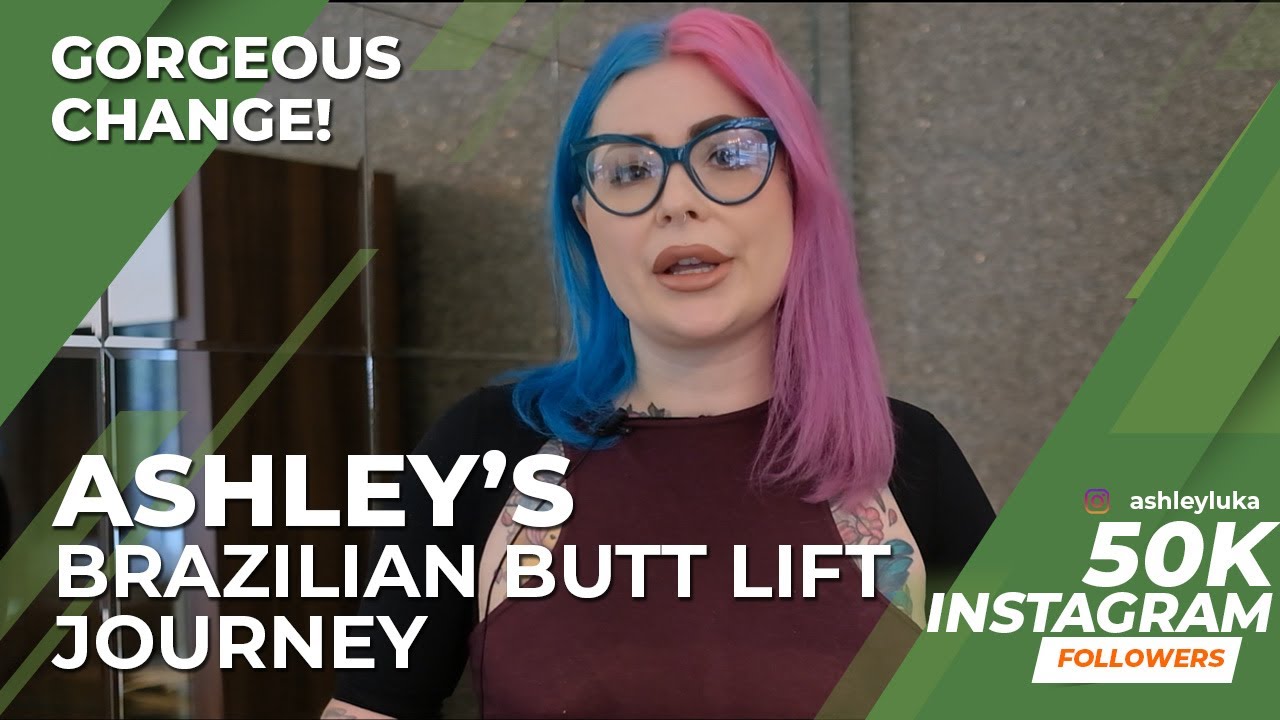 BRAZILIAN BUTT LIFT IN TURKEY | Ashley's BBL in Turkey