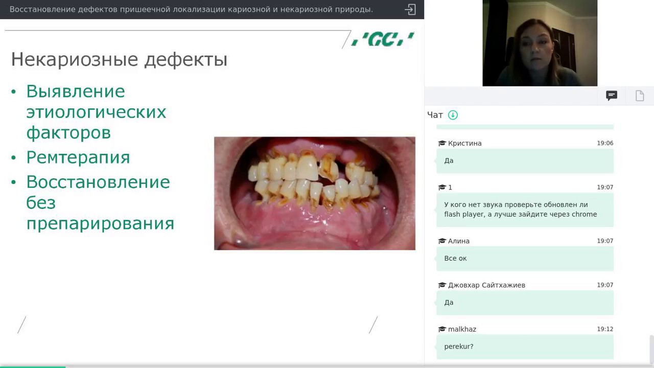 Пришеечные дефекты (Вебинар от 12.12.17)