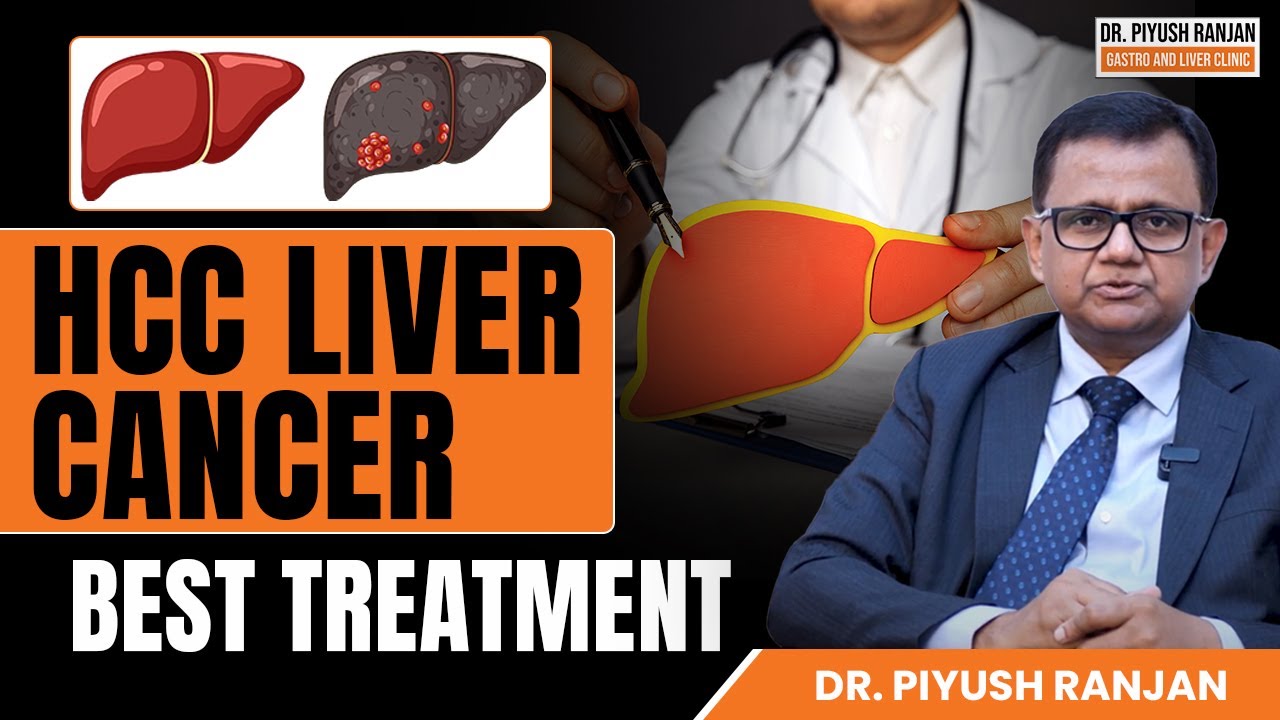 HCC Liver Cancer Treatment | Primary Liver Cancer | Dr. Piyush Ranjan, Delhi