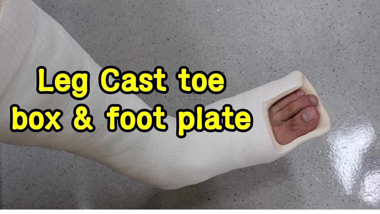 Short Leg Cast toe box foot plate