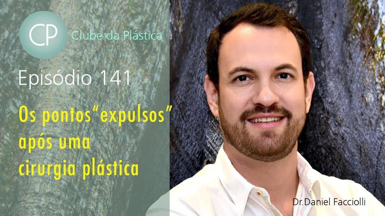 Clube da Plástica: Os pontos 