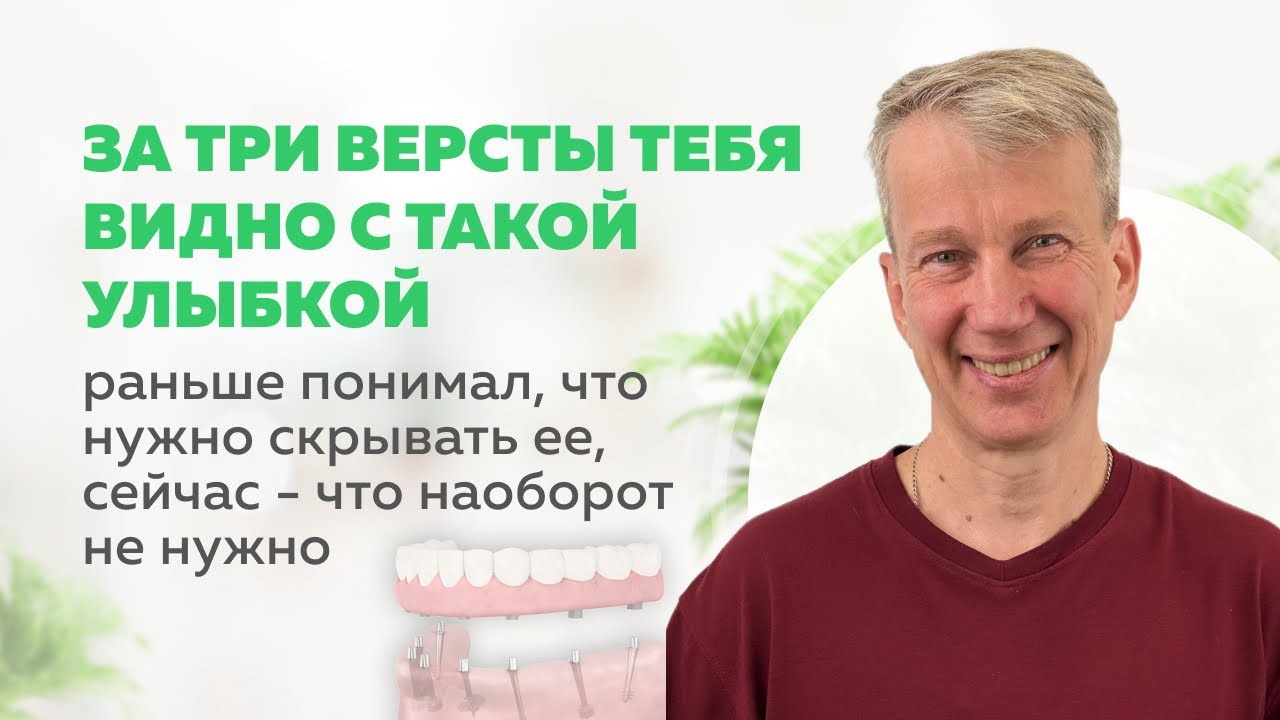 «За три версты тебя видно с такой улыбкой» | Стратегическая имплантация во Владимире