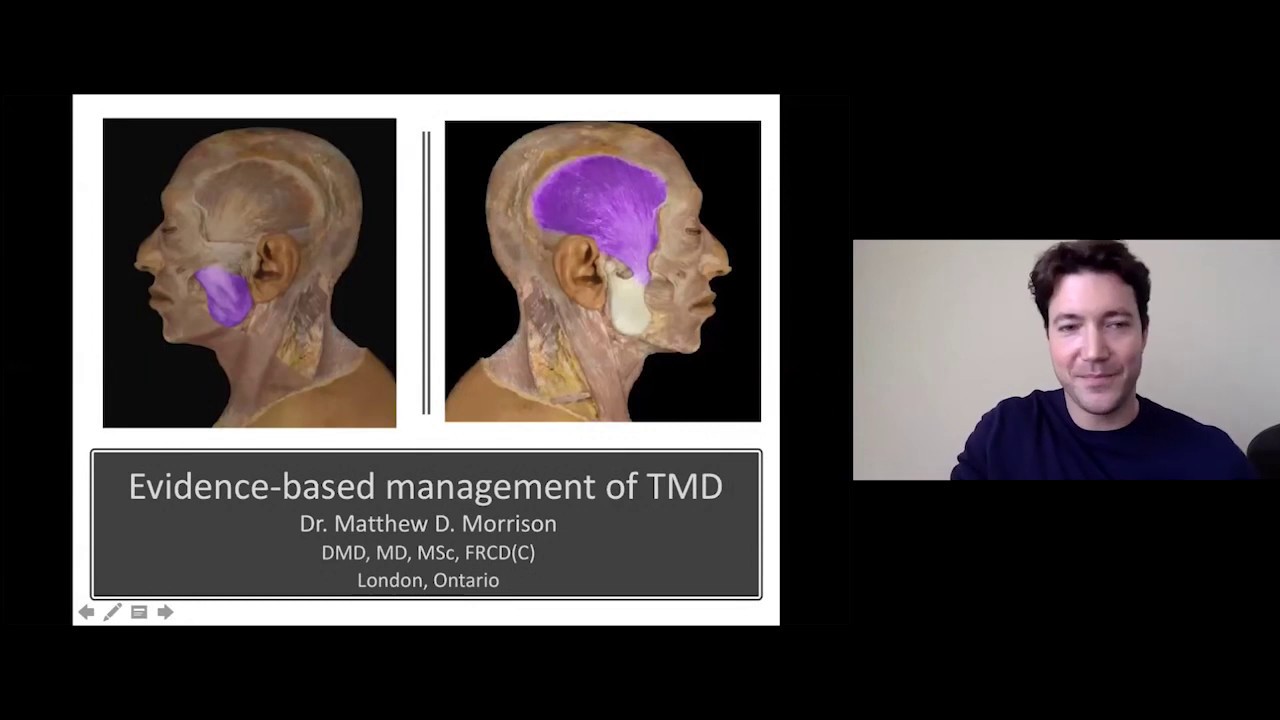 Evidence-Based Management of TMD by Dr. Matt Morrison