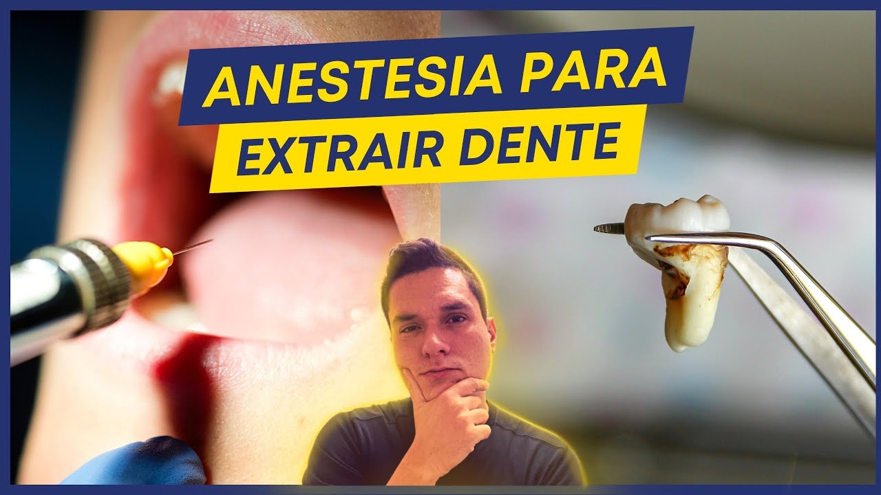 COMO FUNCIONA O PROCEDIMENTO DE ANESTESIA PARA EXTRAIR UM DENTE?