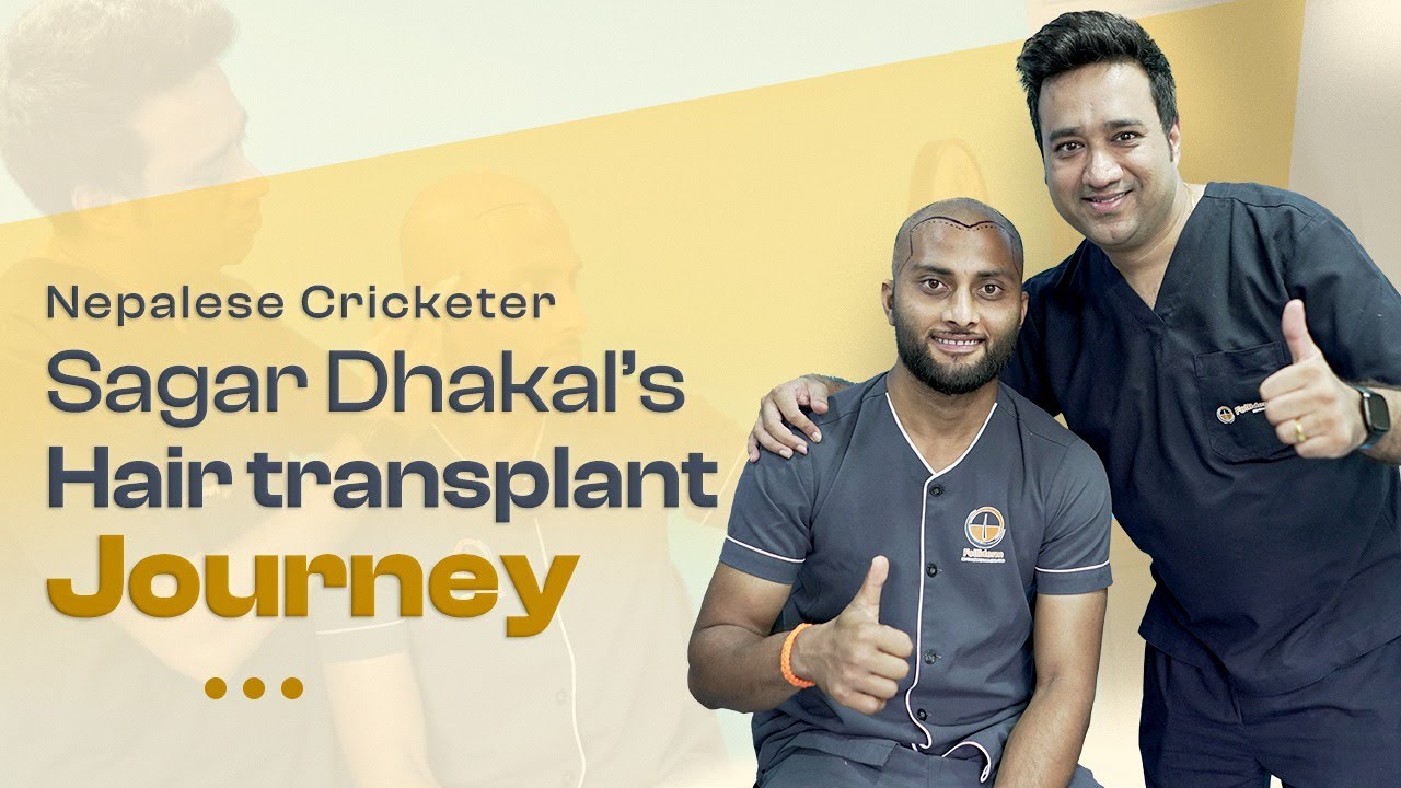 Nepal's cricket star, Sagar Dhakal's hair transplant journey.