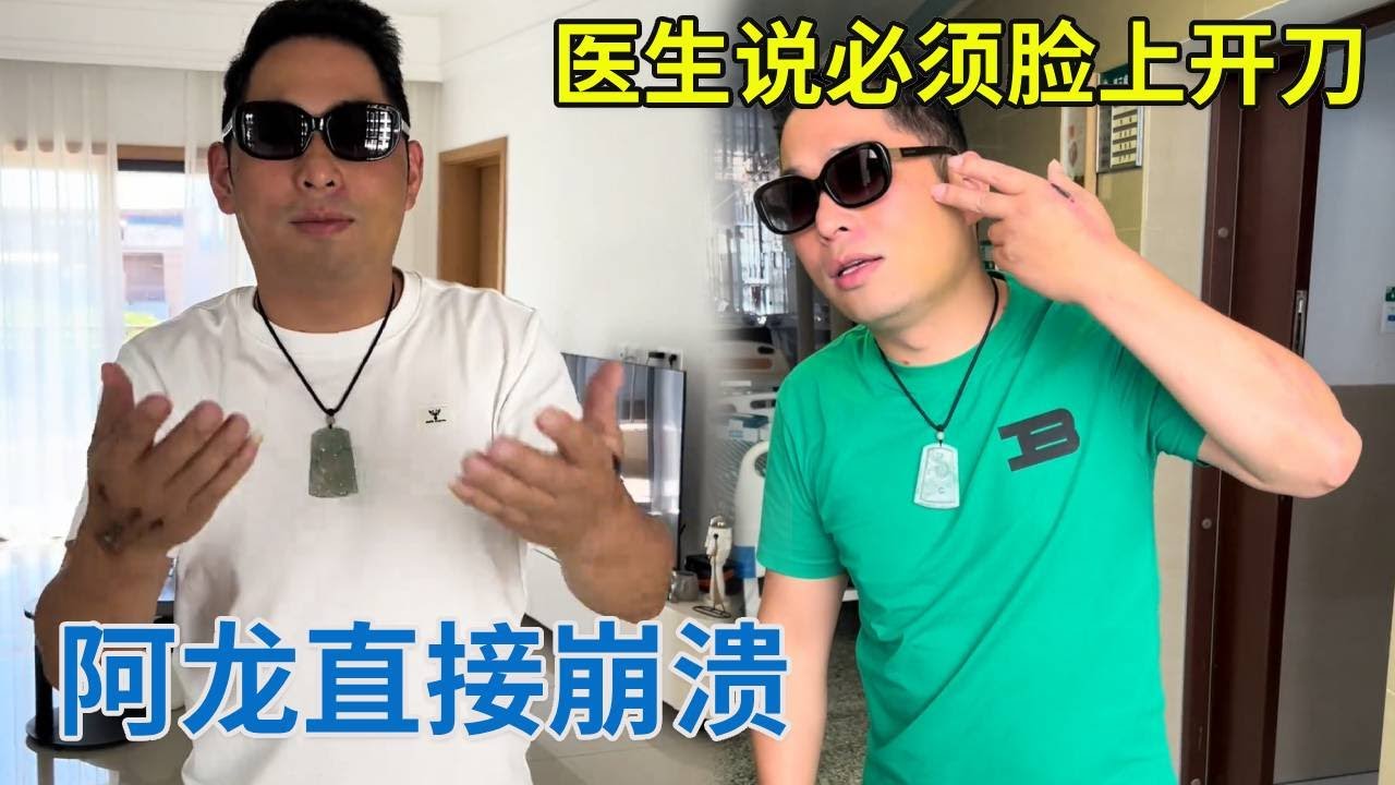 医生说必须脸上开刀，阿龙直接崩溃，大家给点建议！【阿龙游四方】