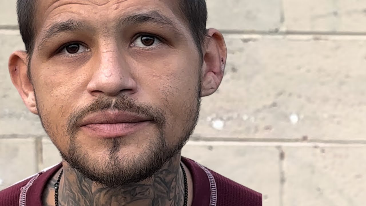 Pablo 10 Toes Amputated Update