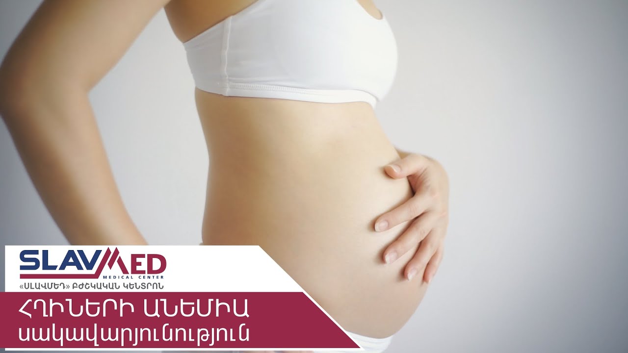 ՀՂԻՆԵՐԻ ԱՆԵՄԻԱ սակավարյունություն