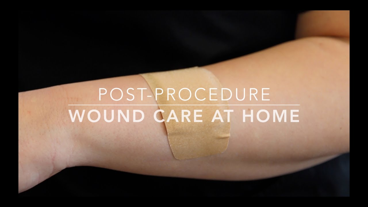 How to Take Care of Your Biopsy Wound