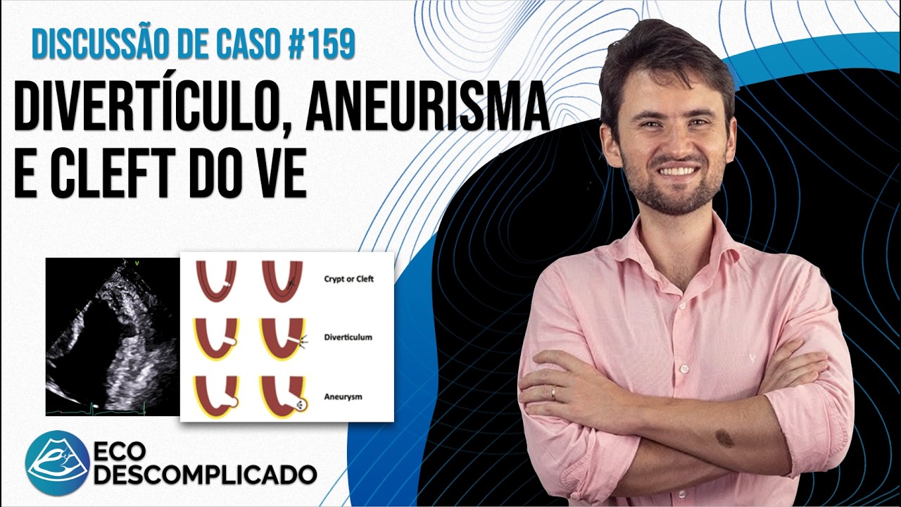 Дивертикул, аневризма или расщепление левого желудочка? | EcoDescomplicado - Обсуждение случая № 159