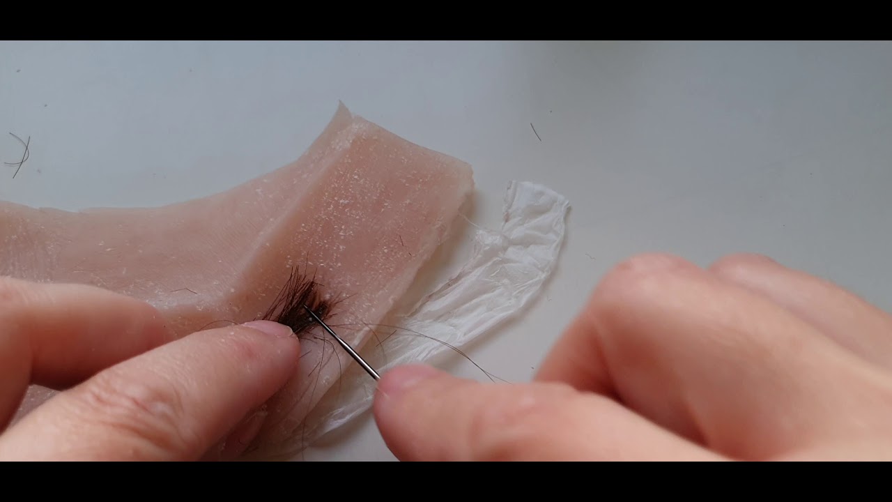 inyección de pelo en prótesis de silicona (punching)