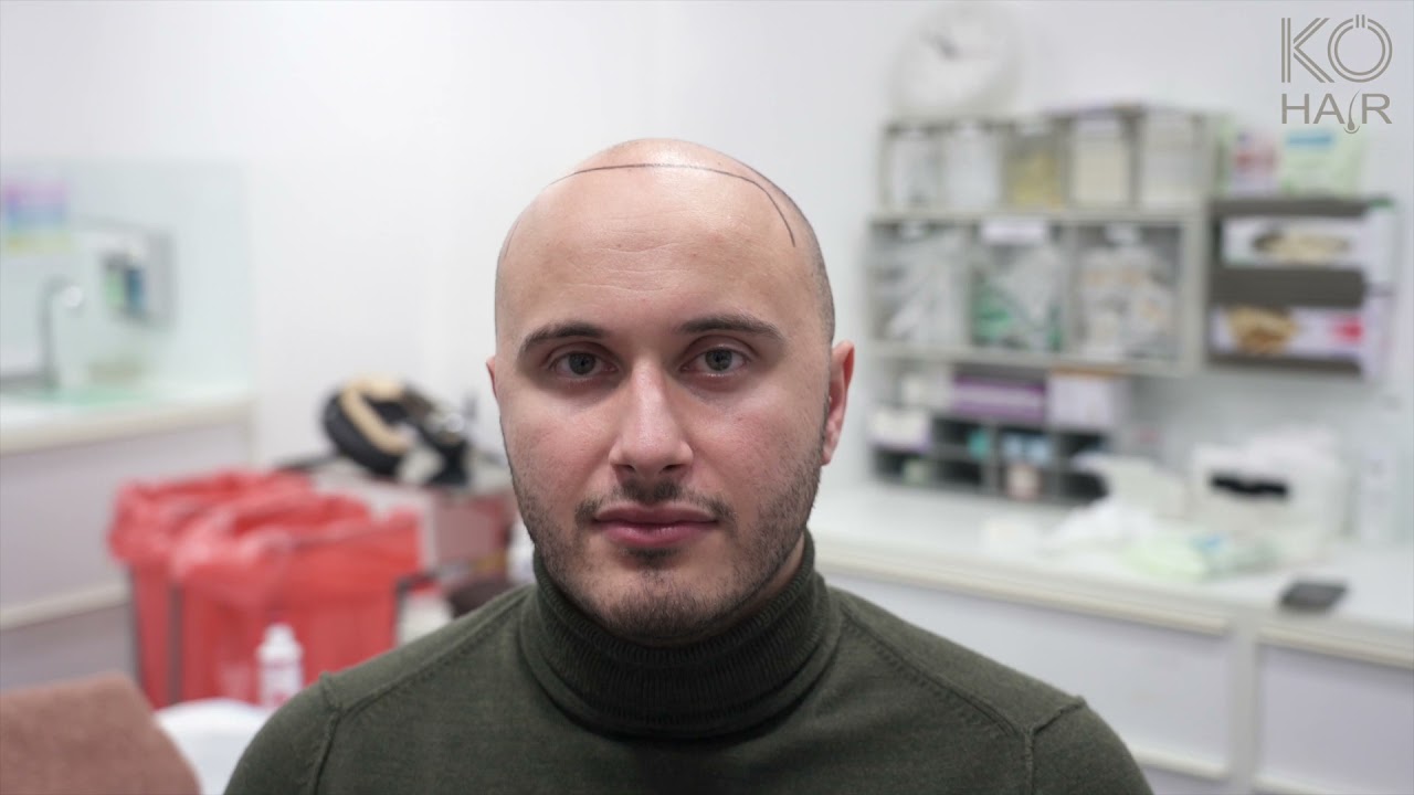 So läuft eine Haarpigmentierung ab - KÖ-HAIR