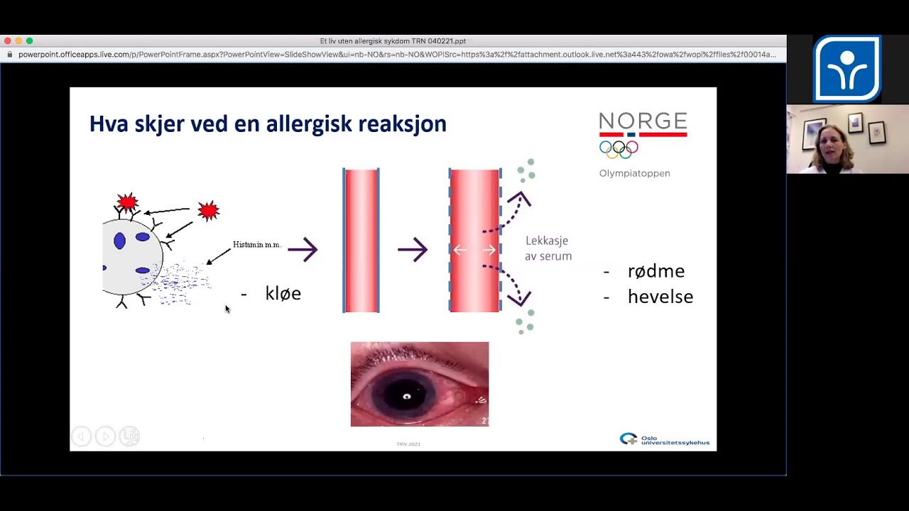 Webinar 