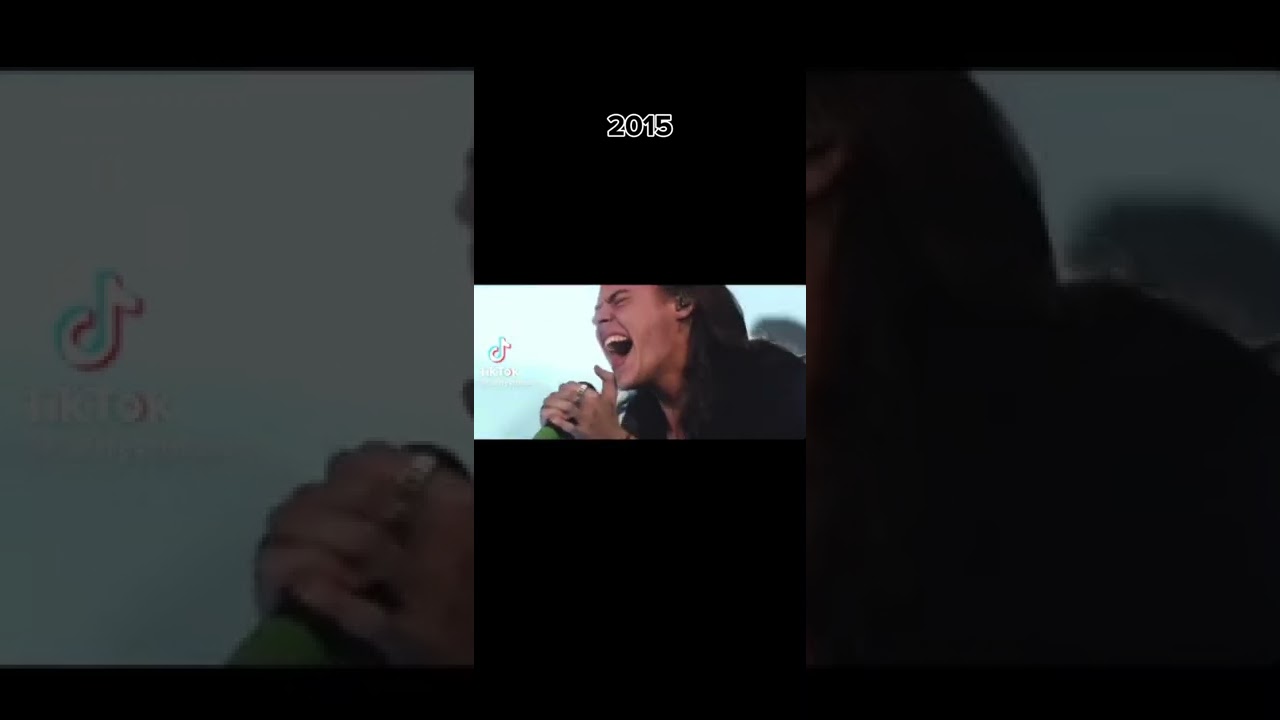 Evolution Harry Styles singing 2010-2022 