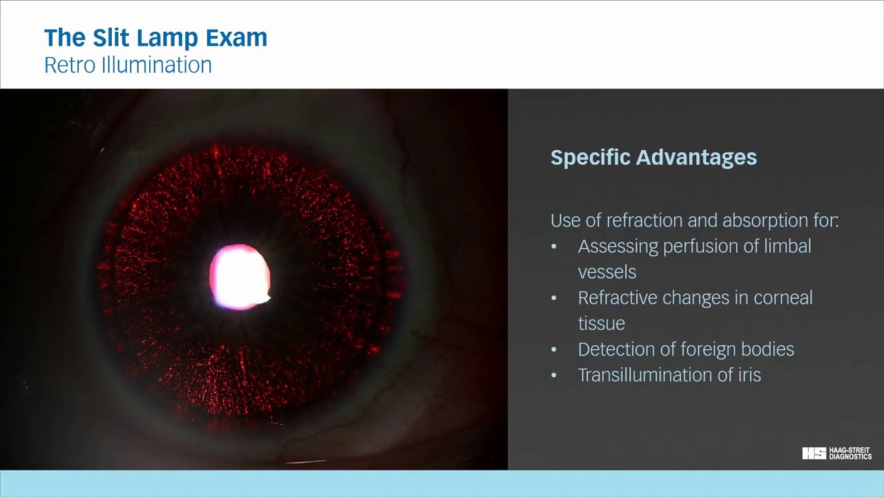 The Slit Lamp Exam - Episode 5  Retro Illumination