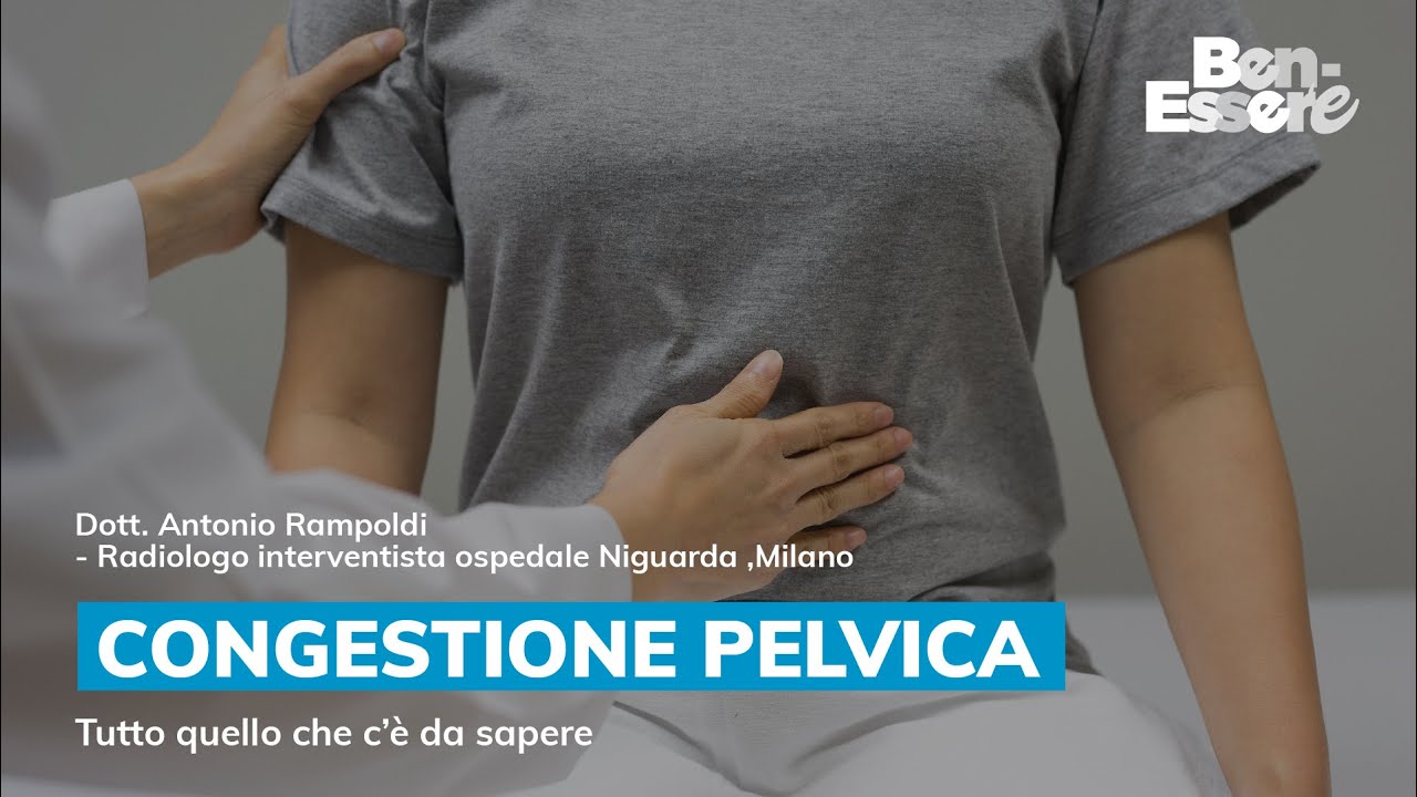 CONGESTIONE PELVICA: tutto quello che c'è da sapere