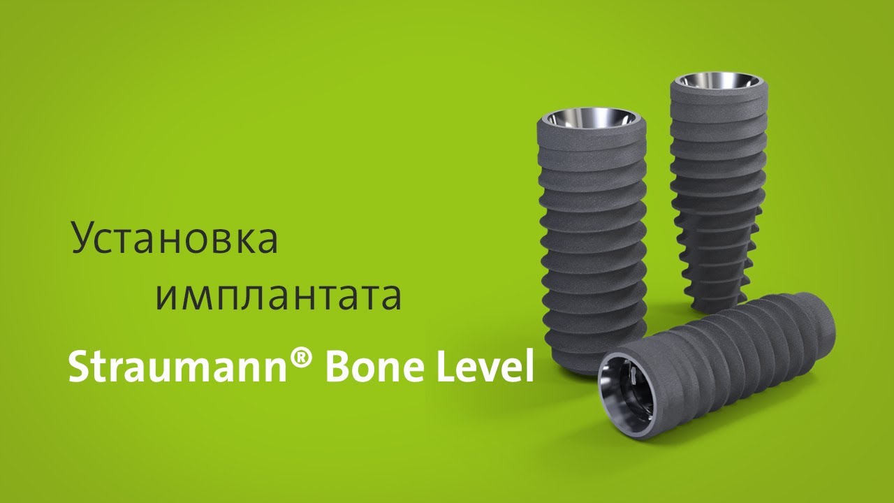 Установка имплантата: Straumann® Bone Level