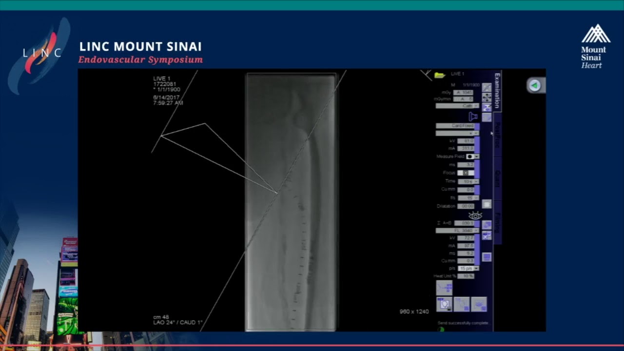 Live Case Presentation #9
