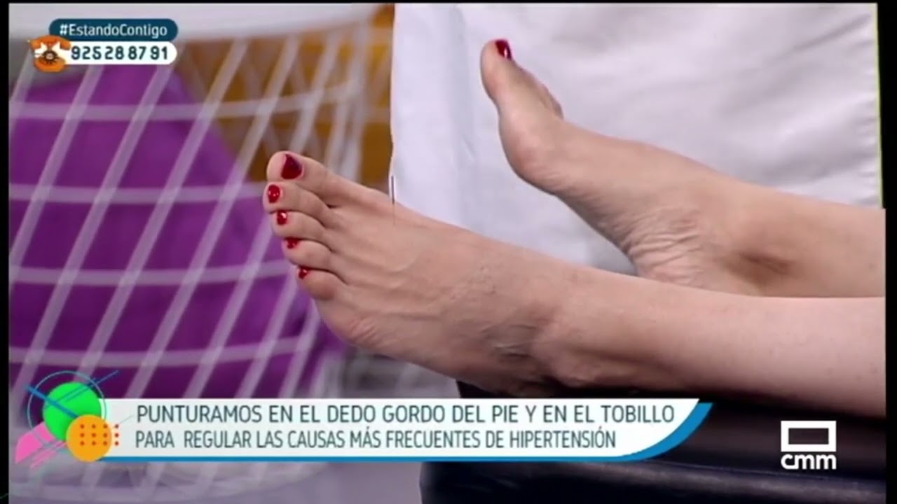 Acupuntura para la Hipertensión Arterial