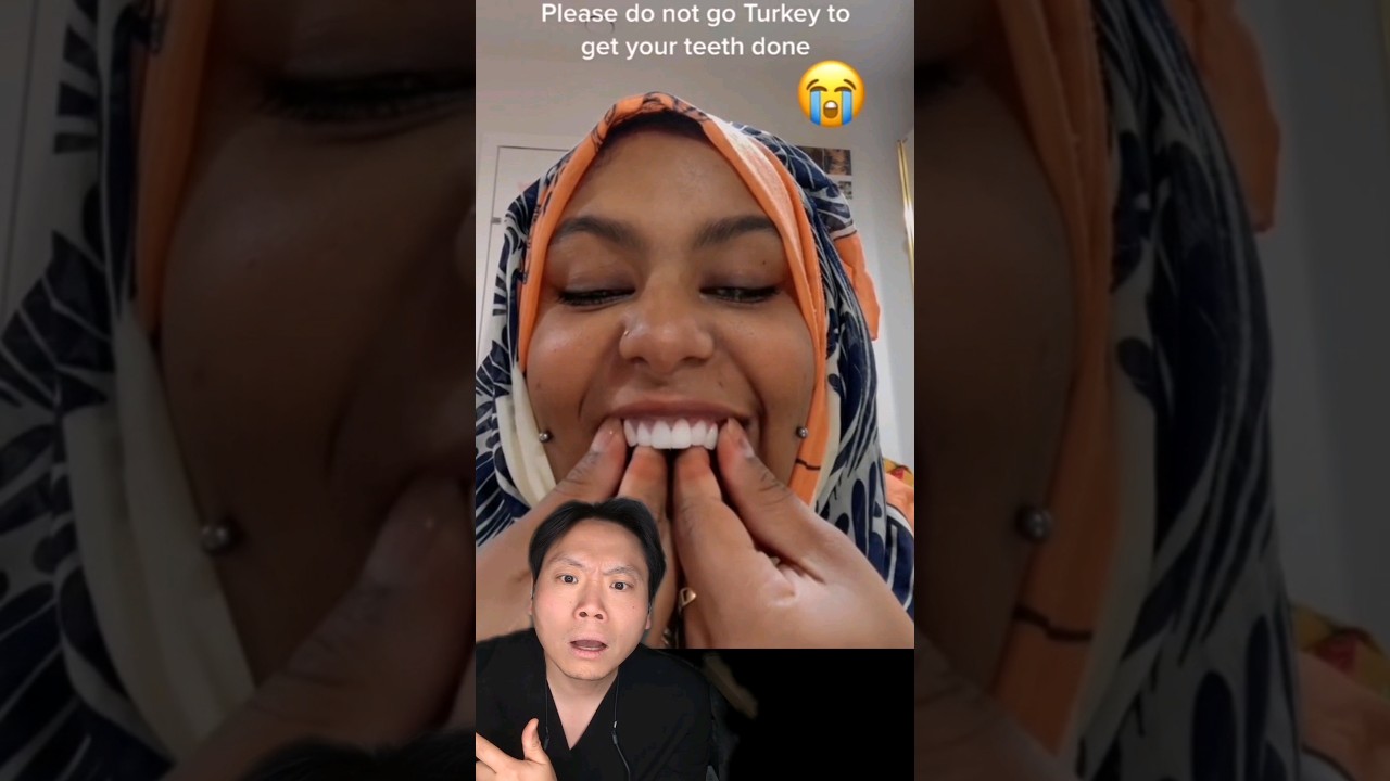 Turkey Teeth Gone Wrong - Dentist Reacts! #smile #turkeyteeth #missingteeth