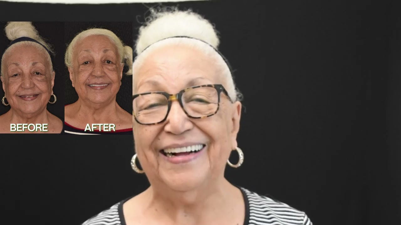 "My grandkids all tell me I look great."