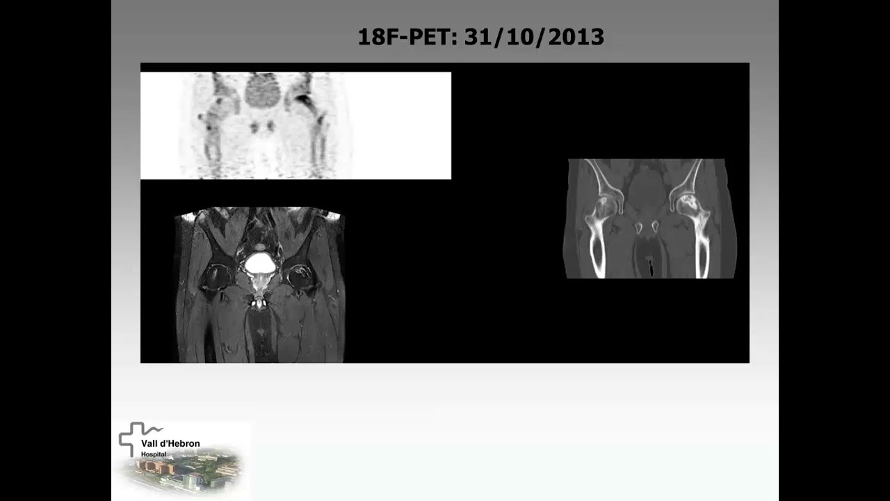 bone viability spect/ct & pet/ct