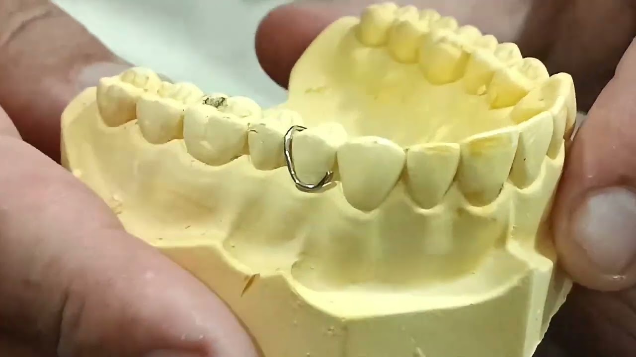 Retenedor circunferencial y en clip - (Dr. Cesar Cortez Sosa)