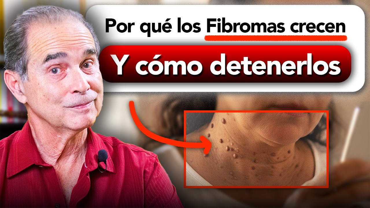 Por Qué Los Fibromas Crecen… Y Cómo Detenerlos