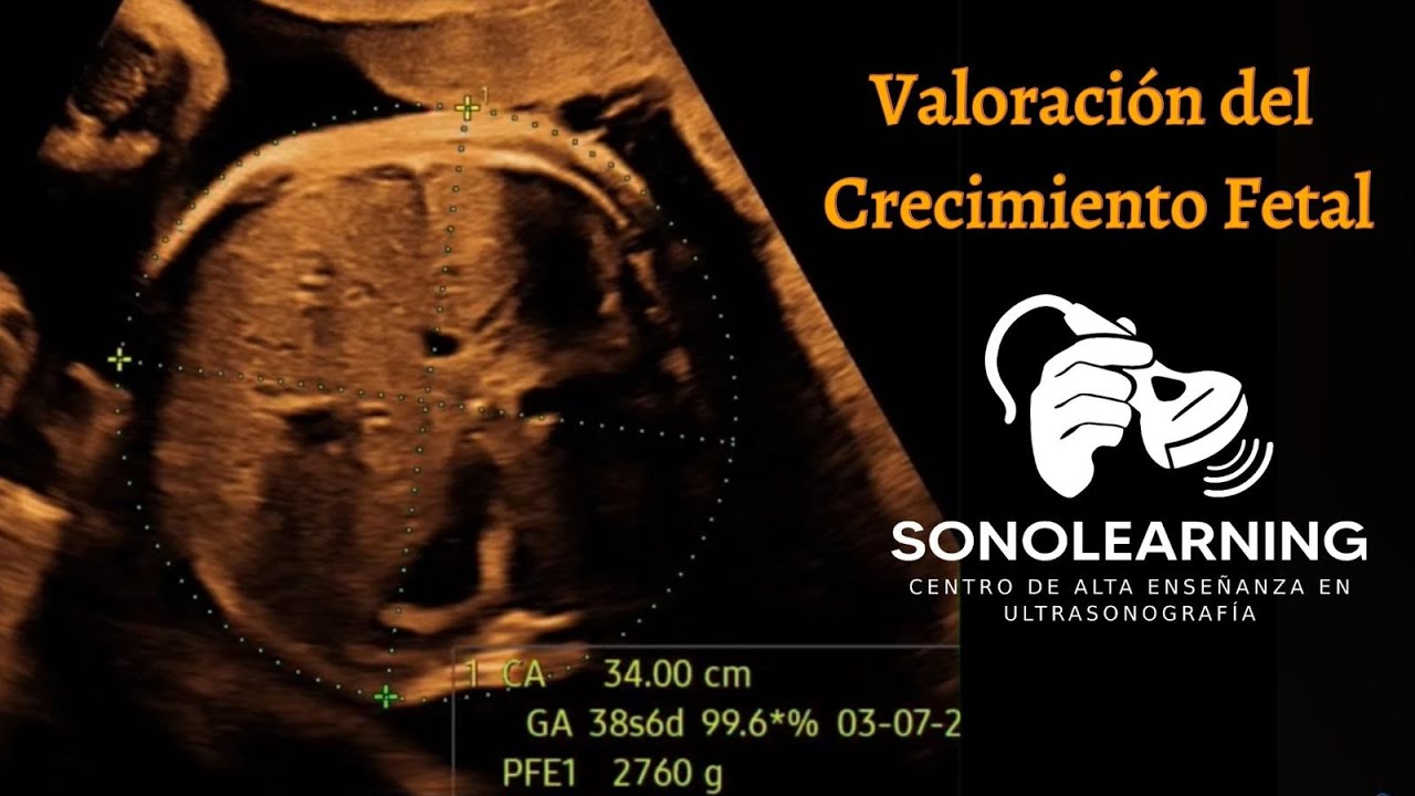 VALORACION DEL CRECIMIENTO FETAL