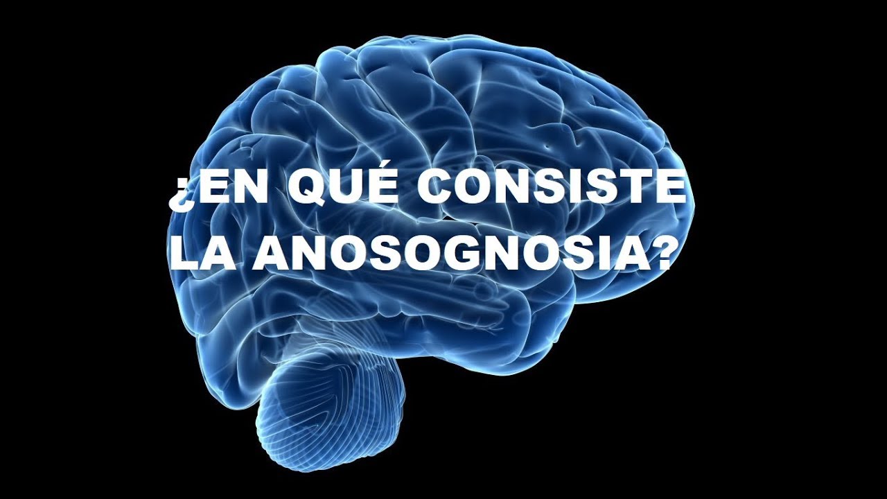 ¿En qué consiste la Anosognosia?