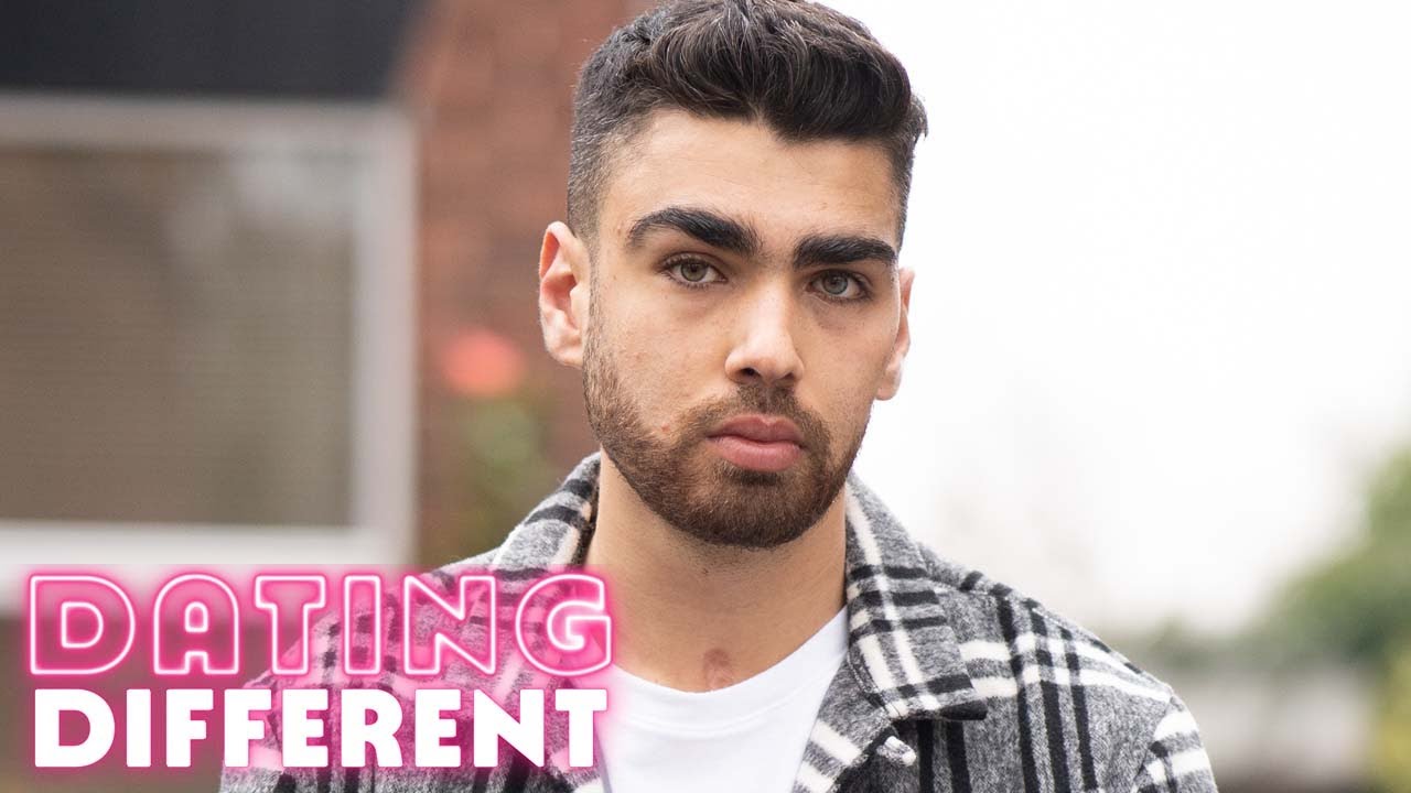 I’m A Disabled Model - How Will My Date React? | DATING DIFFERENT