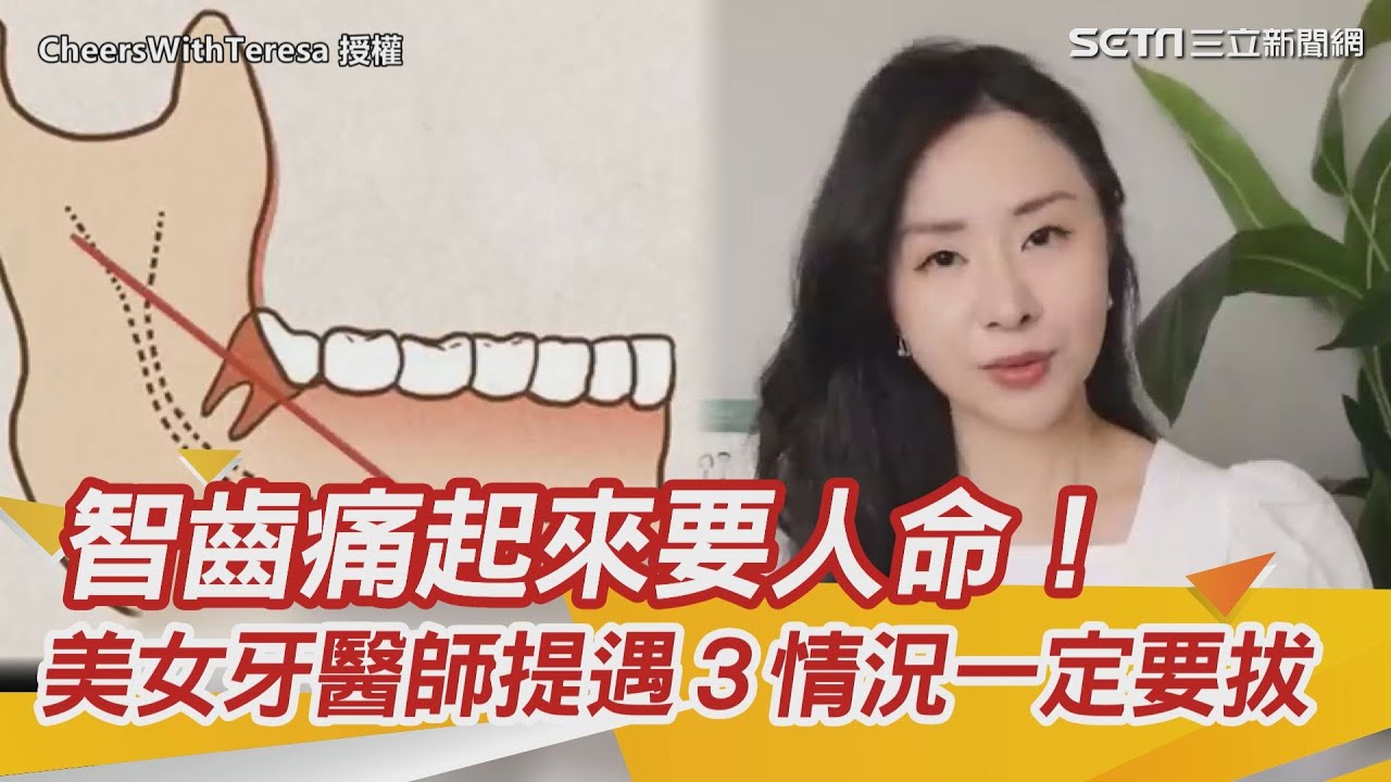 智齒要拔嗎？拔智齒會痛嗎？有3種情況一定要拔！牙醫教你3招減輕疼痛！不拔智齒會怎樣？智齒一定要拔嗎？智齒怎麼拔？拔智齒注意事項有哪些？｜健康資訊、健康知識 都在 祝你健康｜@DrTeresa