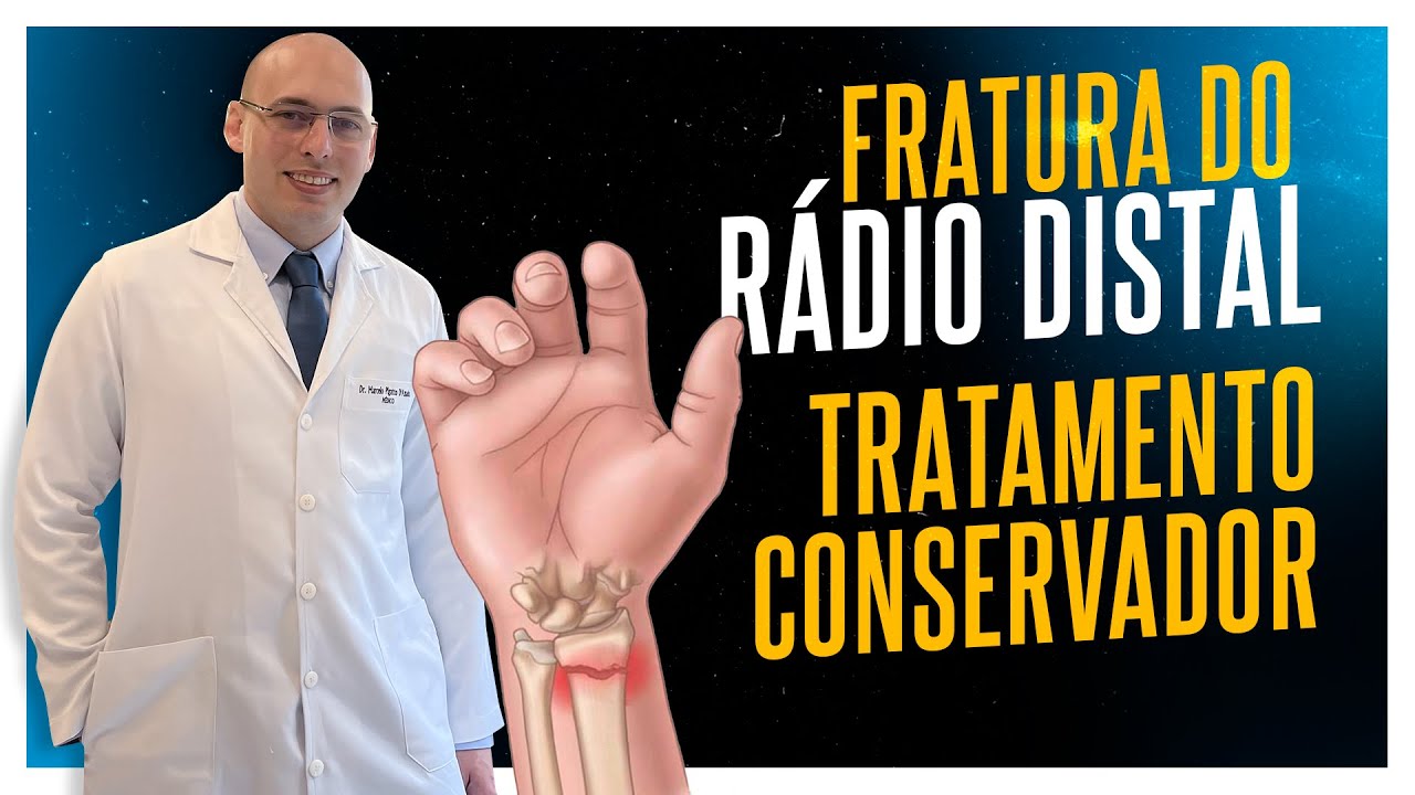 FRATURA DO RÁDIO DISTAL | COMO É O TRATAMENTO CONSERVADOR COM GESSO 3D?