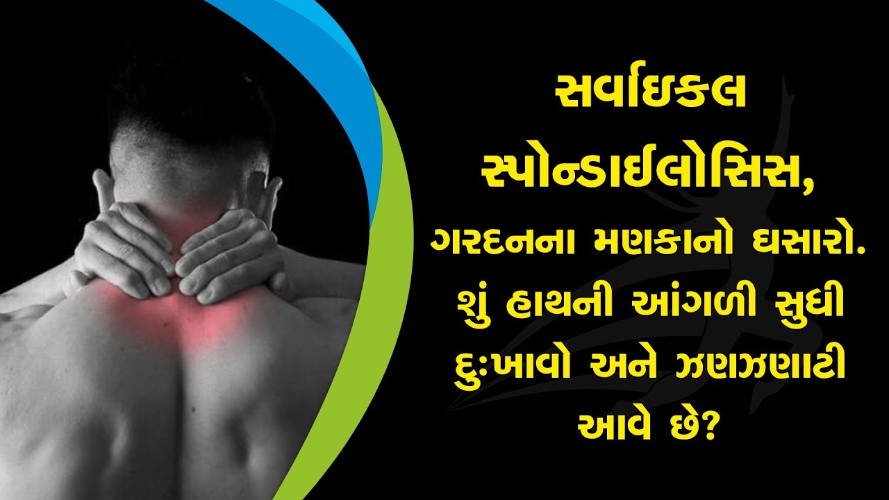 What is cervical spondylosis and its causes and how can it be treated at home?
